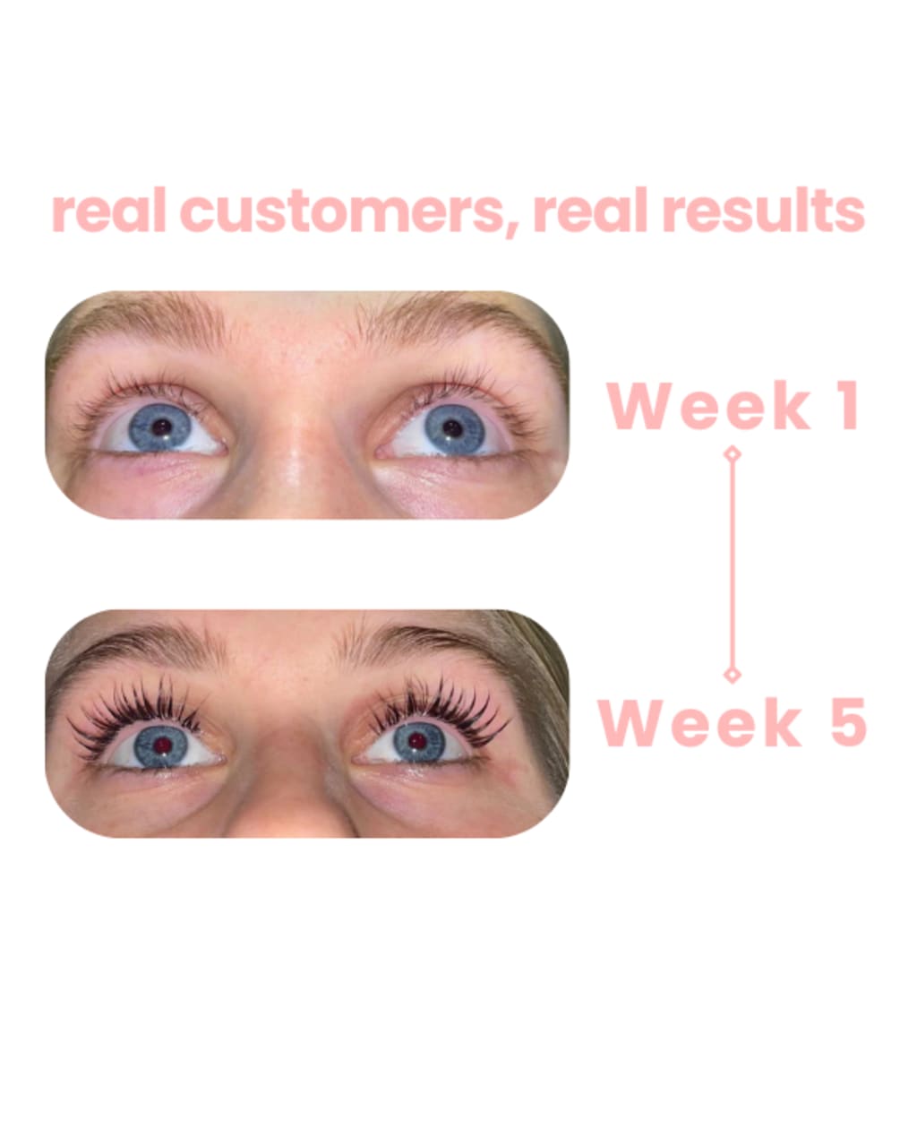 Sylvora™ Eyelash Growth Serum