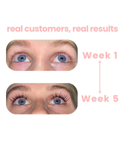 Sylvora™ Eyelash Growth Serum